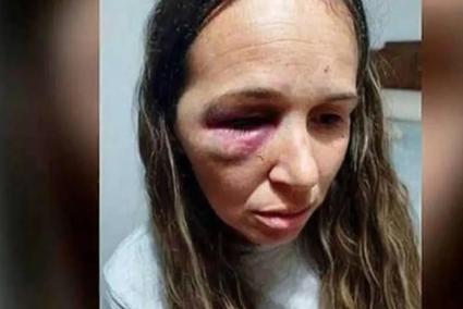 Palizón salvaje a una pareja que intenta recuperar su vivienda okupada